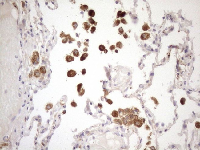CIAPIN1 Antibody in Immunohistochemistry (Paraffin) (IHC (P))