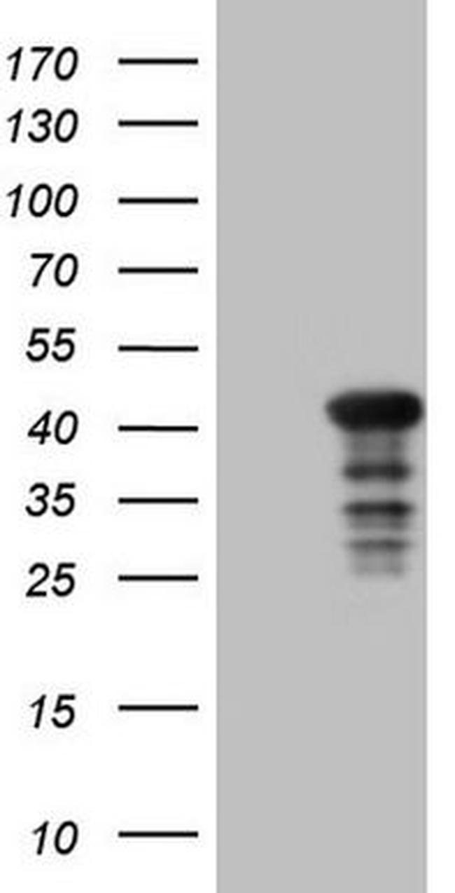 CIAPIN1 Antibody in Western Blot (WB)