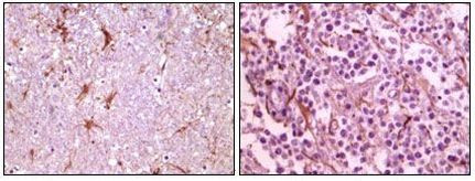 Calmyrin Antibody in Immunohistochemistry (Paraffin) (IHC (P))