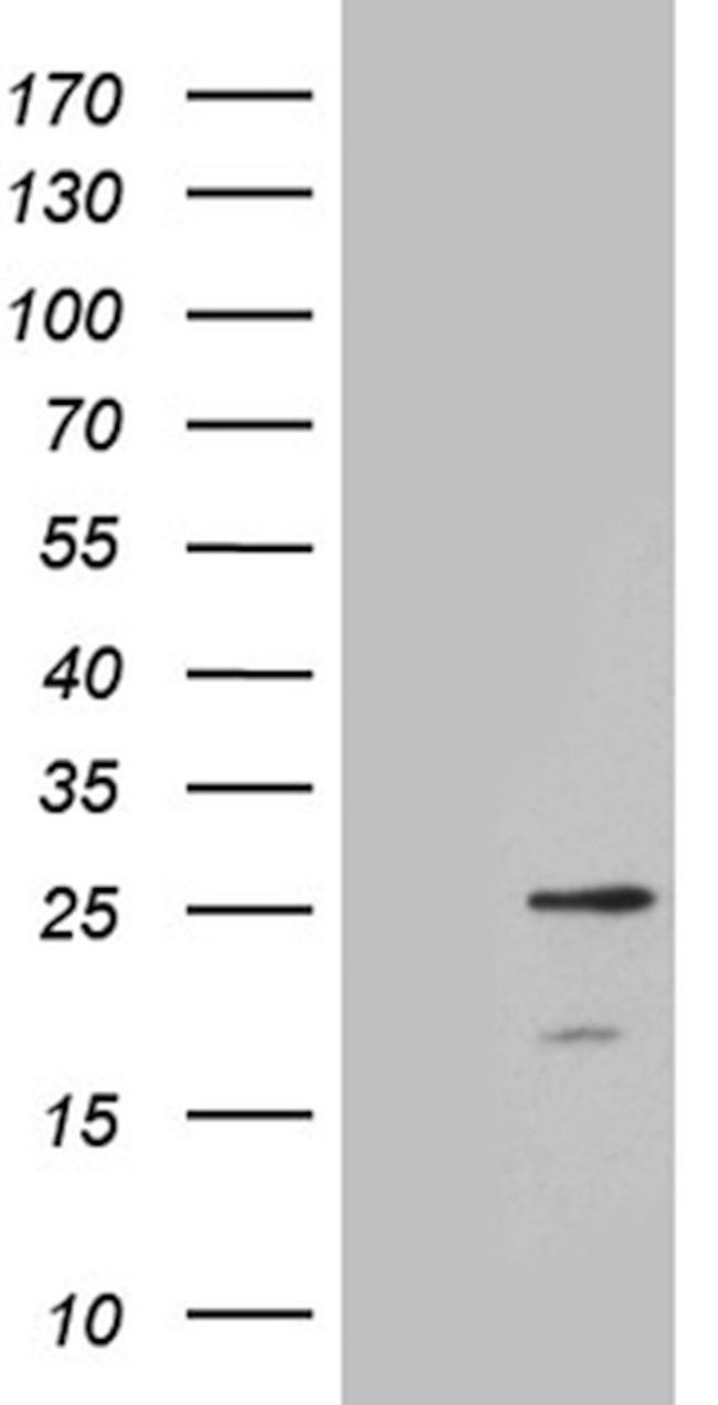 CIB3 Antibody in Western Blot (WB)