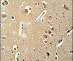 CILP2 Antibody in Immunohistochemistry (IHC)
