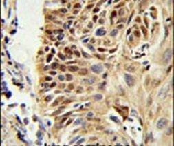 CIRBP Antibody in Immunohistochemistry (IHC)