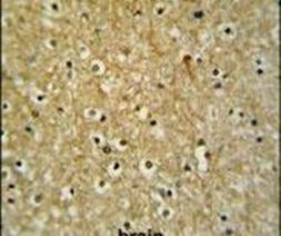 CIRH1A Antibody in Immunohistochemistry (IHC)