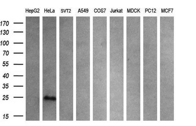 CITED1 Antibody in Western Blot (WB)
