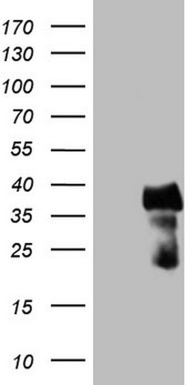 CITED1 Antibody in Western Blot (WB)