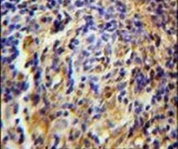 C11orf73 Antibody in Immunohistochemistry (IHC)
