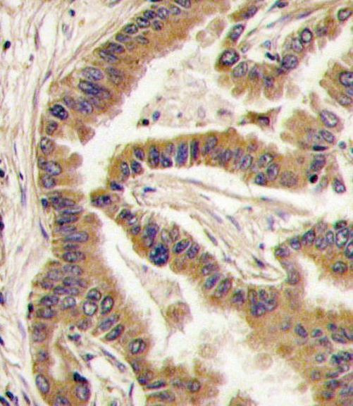 CK1 alpha Antibody in Immunohistochemistry (IHC)