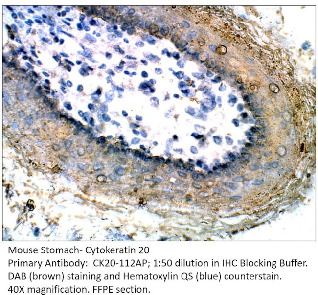 Cytokeratin 20 Antibody in Immunohistochemistry (Paraffin) (IHC (P))