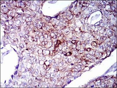 Ck5 Cytokeratin 5 Monoclonal Antibody (2C2) (MA5-17057)