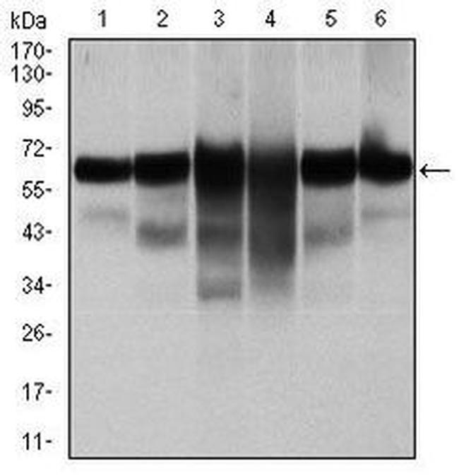 Ck5 Cytokeratin 5 Monoclonal Antibody (2C2) | Invitrogen (MA5-17057)