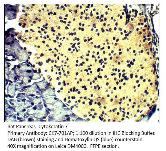 Cytokeratin 7 Antibody in Immunohistochemistry (IHC)