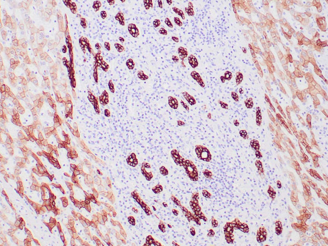 Cytokeratin 8 Antibody in Immunohistochemistry (Paraffin) (IHC (P))