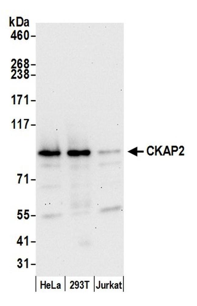 CKAP2 Antibody in Western Blot (WB)
