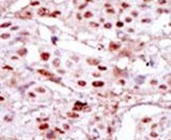 CK2 alpha-1 Antibody in Immunohistochemistry (IHC)