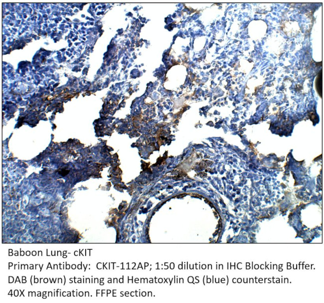 cKit Antibody in Immunohistochemistry (IHC)