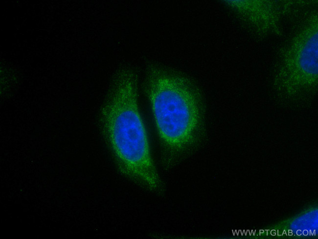 MEF2C Antibody in Immunocytochemistry (ICC/IF)