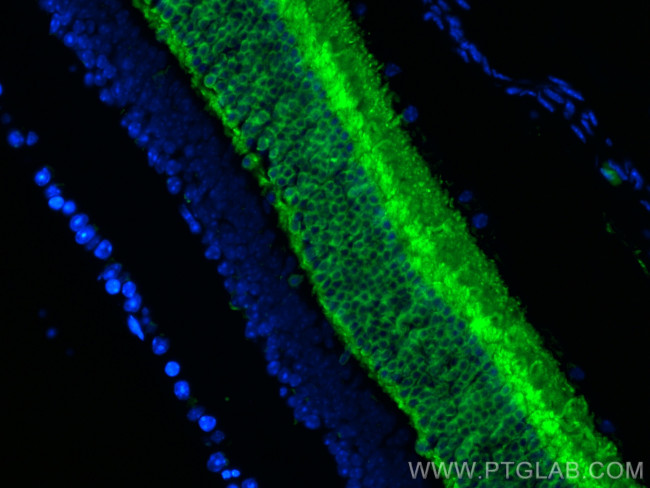 Recoverin Antibody in Immunohistochemistry (PFA fixed) (IHC (PFA))