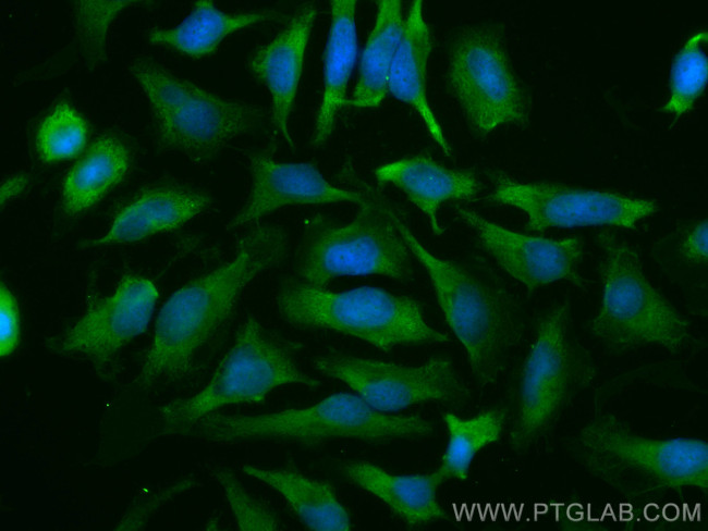 Importin Beta Antibody in Immunocytochemistry (ICC/IF)