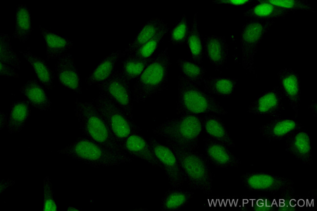 UBE2T/HSPC150 Antibody in Immunocytochemistry (ICC/IF)