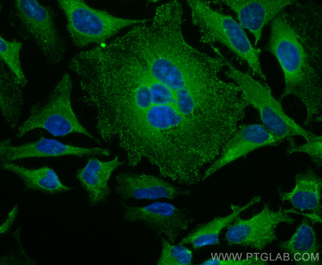 DAB2 Antibody in Immunocytochemistry (ICC/IF)