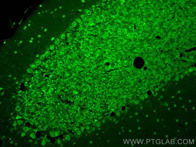 NUMBL Antibody in Immunohistochemistry (PFA fixed) (IHC (PFA))