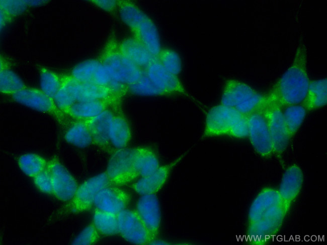 DOPA decarboxylase Antibody in Immunocytochemistry (ICC/IF)