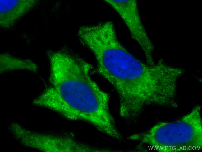 AKT Antibody in Immunocytochemistry (ICC/IF)