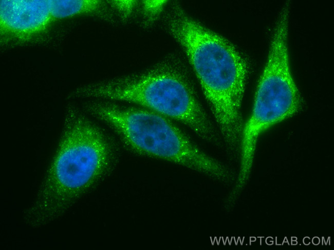 RCN2 Antibody in Immunocytochemistry (ICC/IF)