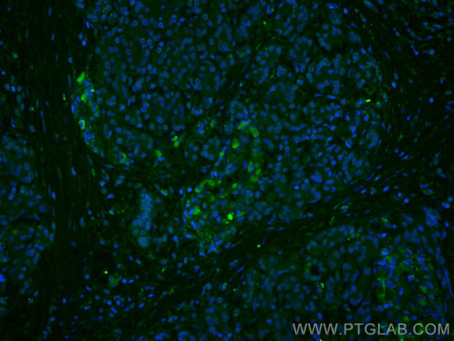 ubiquitin Antibody in Immunohistochemistry (PFA fixed) (IHC (PFA))