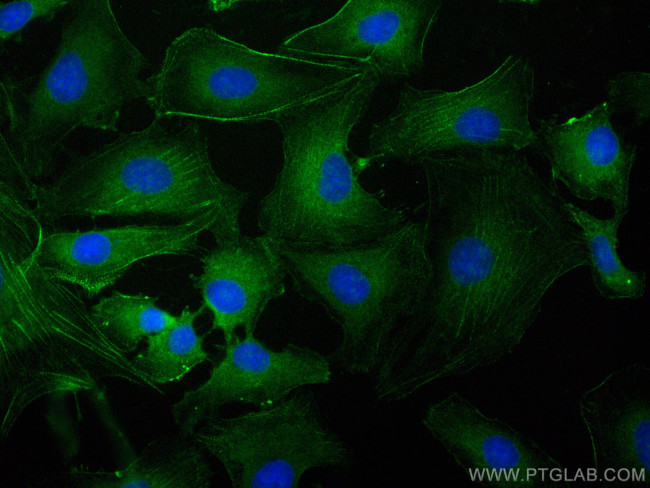 PDLIM7 Antibody in Immunocytochemistry (ICC/IF)