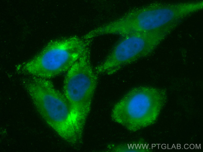 EIF2S2 Antibody in Immunocytochemistry (ICC/IF)