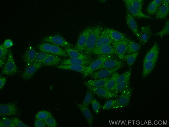 VPS35 Antibody in Immunocytochemistry (ICC/IF)