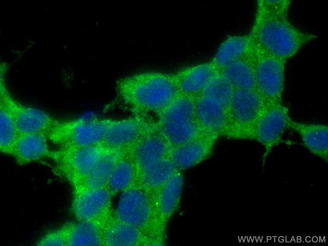 CPLX1 Antibody in Immunocytochemistry (ICC/IF)