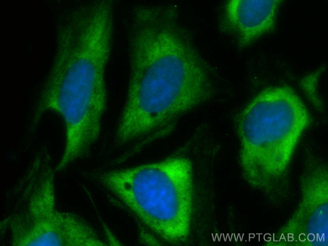 Cdc20 Antibody in Immunocytochemistry (ICC/IF)