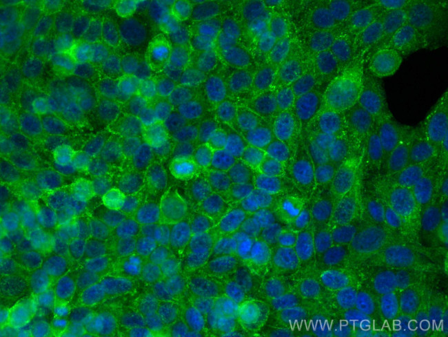 Drebrin Antibody in Immunocytochemistry (ICC/IF)