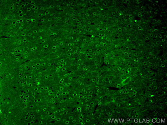 TAU Antibody in Immunohistochemistry (PFA fixed) (IHC (PFA))