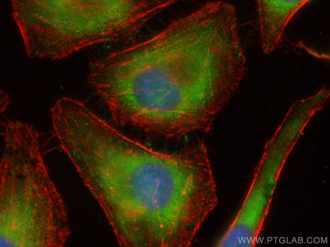 TCP1 Antibody in Immunocytochemistry (ICC/IF)