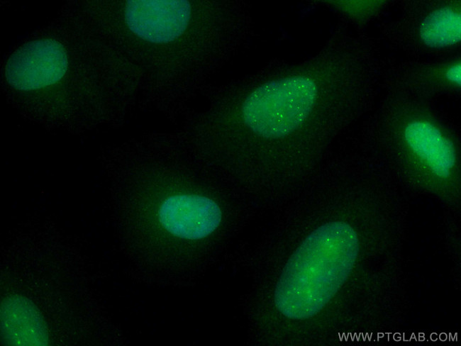 SUMO1 Antibody in Immunocytochemistry (ICC/IF)
