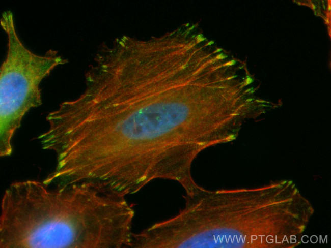 Zyxin Antibody in Immunocytochemistry (ICC/IF)