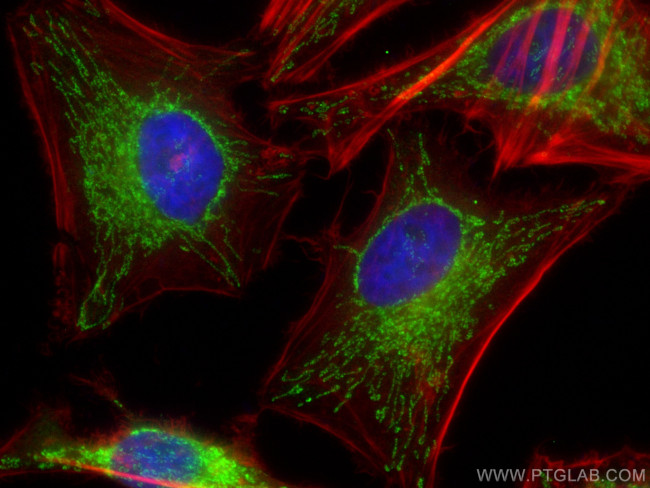 STOML2 Antibody in Immunocytochemistry (ICC/IF)