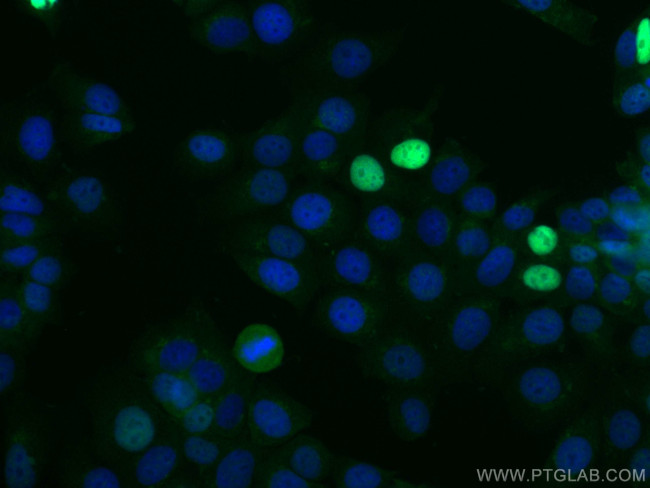 P21 Antibody in Immunocytochemistry (ICC/IF)