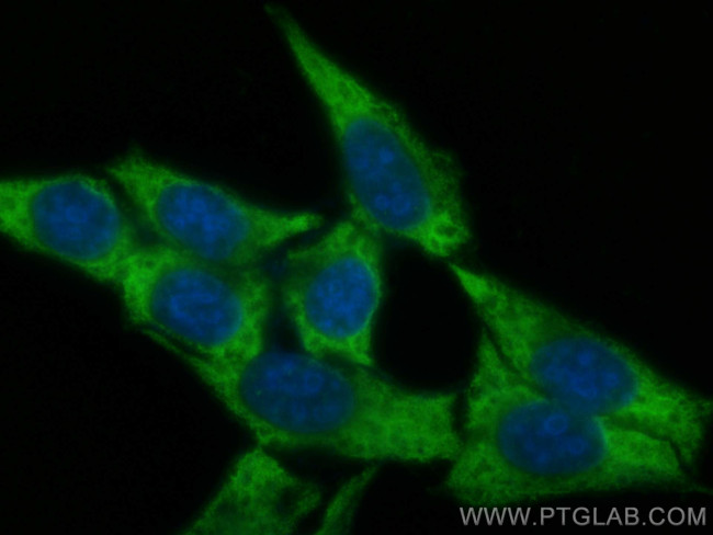 MMP2 Antibody in Immunocytochemistry (ICC/IF)