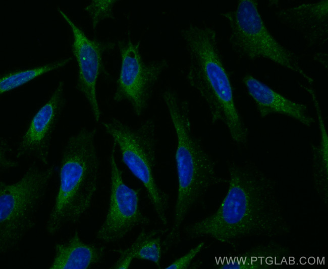 HGS Antibody in Immunocytochemistry (ICC/IF)