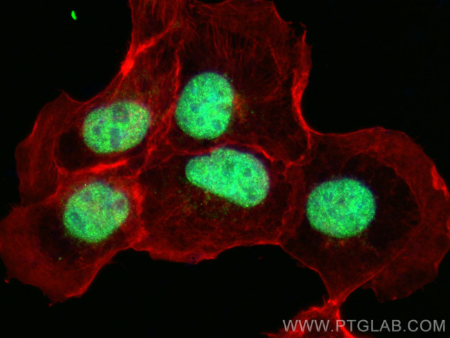 RPA2 Antibody in Immunocytochemistry (ICC/IF)