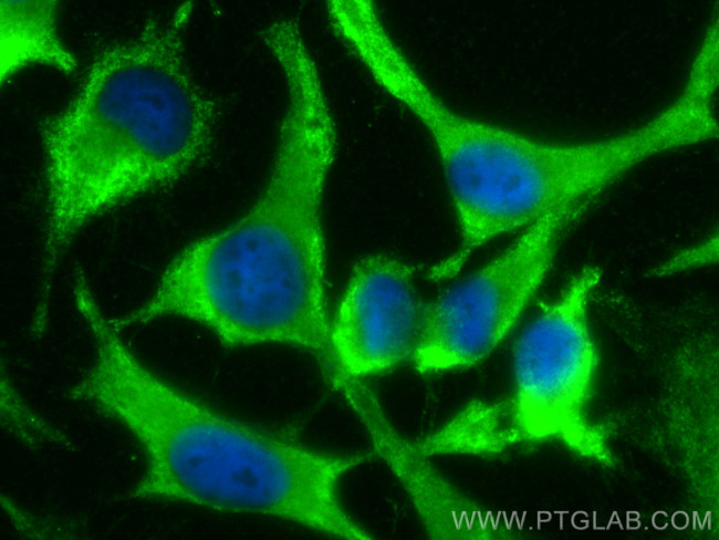 CLTB Antibody in Immunocytochemistry (ICC/IF)