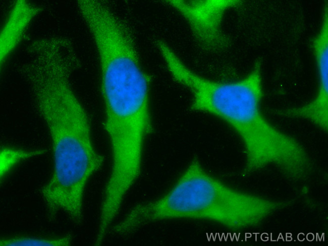 S100A14 Antibody in Immunocytochemistry (ICC/IF)