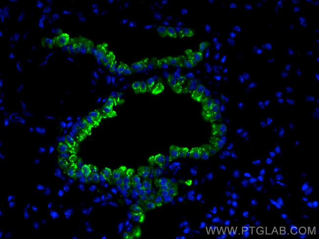 Uteroglobin/CC10 Antibody in Immunohistochemistry (PFA fixed) (IHC (PFA))