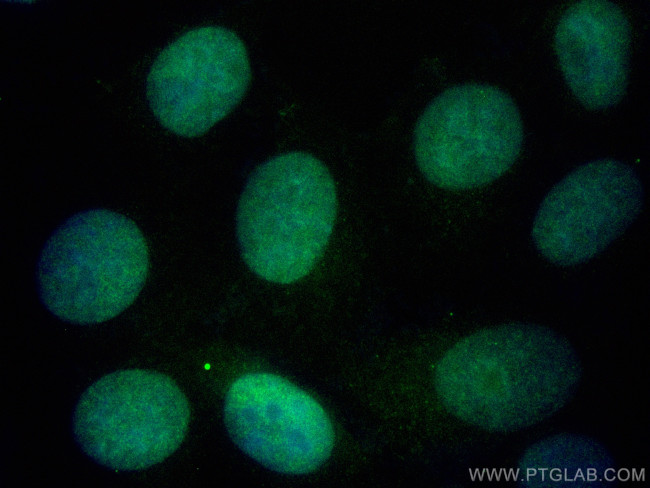 MCM2 Antibody in Immunocytochemistry (ICC/IF)