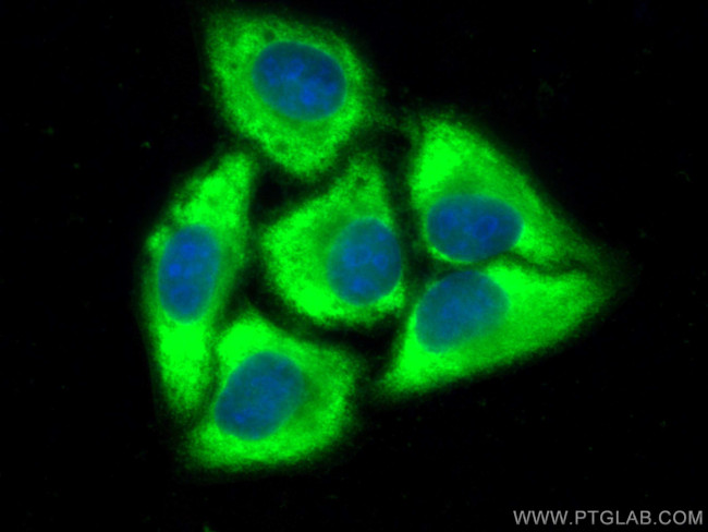 peroxiredoxin 2 Antibody in Immunocytochemistry (ICC/IF)