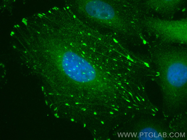 HIC5 Antibody in Immunocytochemistry (ICC/IF)